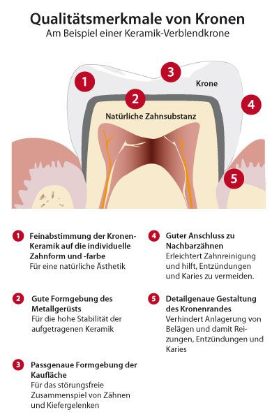 Qualitätsmerkmale Kronen Qualitätsmerkmale Kronen